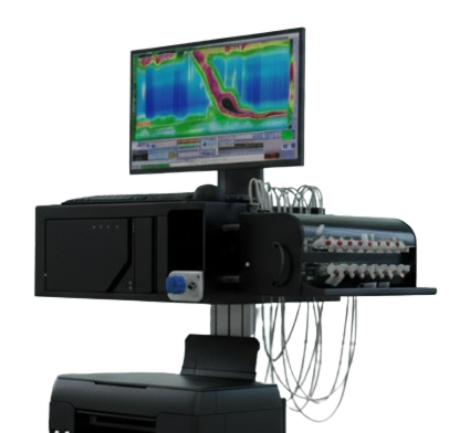 High-Resolution Manometry