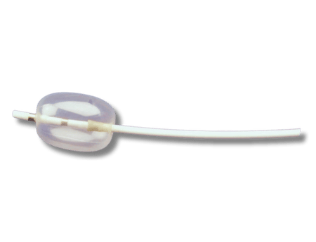 Wire Guided Stone Extraction Balloon